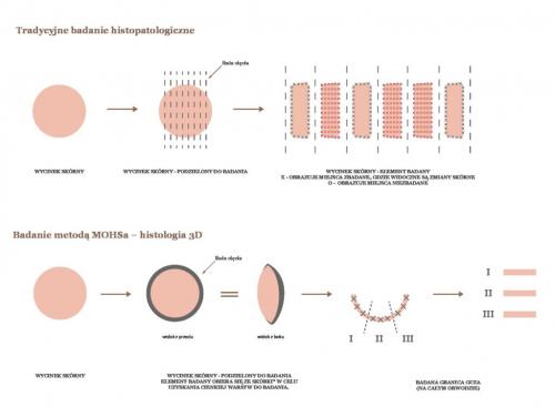 MOHS-roznice-na www-DONE-pdf-1024x772